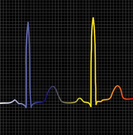 An ecg display to show heart beat or computer related information Stock Photo - Budget Royalty-Free & Subscription, Code: 400-04936567