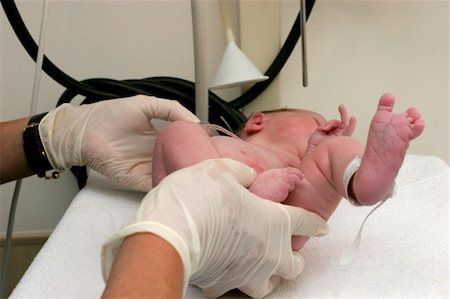 frühgeburt - A new born baby being checked after delivery Stockbilder - Microstock & Abonnement, Bildnummer: 400-04940729