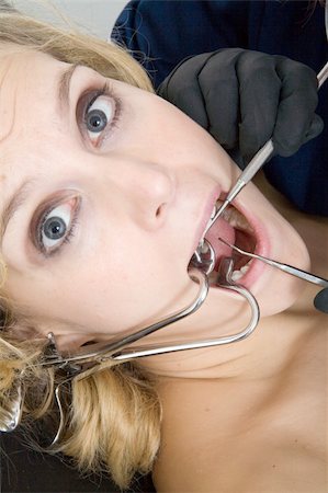 Dentist's patient. Stock Photo - Budget Royalty-Free & Subscription, Code: 400-04943897