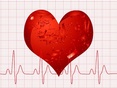 simsearch:400-04292176,k - Illustration of a medical background showing a heart beat over an ecg Stock Photo - Budget Royalty-Free & Subscription, Code: 400-04952837