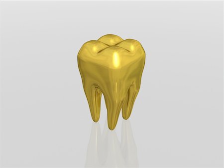 simsearch:400-06108956,k - 3d render of golden tooth Fotografie stock - Microstock e Abbonamento, Codice: 400-05024077