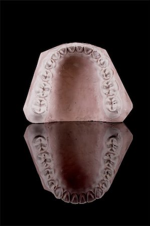 gypsum model of a human teeth on black background Foto de stock - Royalty-Free Super Valor e Assinatura, Número: 400-05097297
