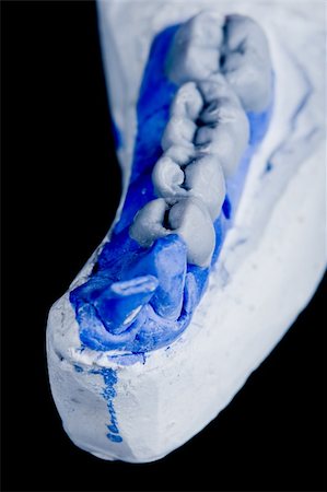 gypsum model of a human teeth on black background Foto de stock - Royalty-Free Super Valor e Assinatura, Número: 400-05097308