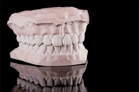gypsum model of a human teeth on black background Stock Photo - Budget Royalty-Free & Subscription, Code: 400-05097300