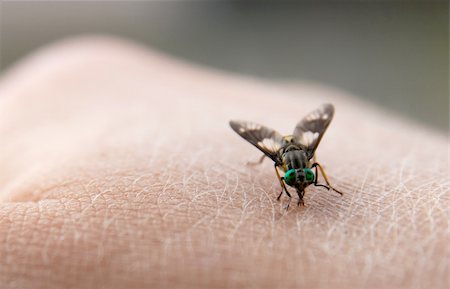 skin disease - Big nasty fly biting in human skin Stock Photo - Budget Royalty-Free & Subscription, Code: 400-05116454