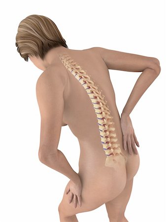 3d rendered illustration of a female body with backache Stock Photo - Budget Royalty-Free & Subscription, Code: 400-05122219