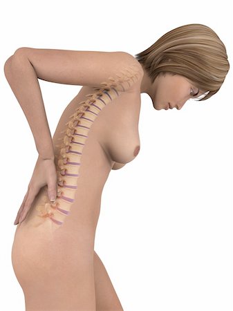 3d rendered illustration of a female body with backache Stock Photo - Budget Royalty-Free & Subscription, Code: 400-05122220