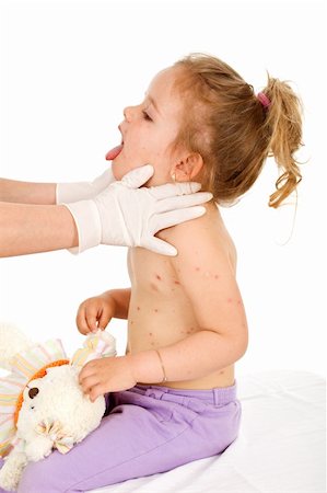 rubber nurse - Little girl with small pox consulted by a physician - isolated Stock Photo - Budget Royalty-Free & Subscription, Code: 400-05139096