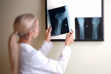 Doctor examining x-ray Stock Photo - Budget Royalty-Free & Subscription, Code: 400-05186275