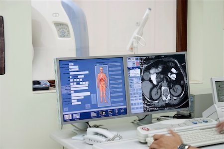 doctor with ct scan - Interior of scanner room with computer and  working X-ray CT scanner. Stock Photo - Budget Royalty-Free & Subscription, Code: 400-05238042