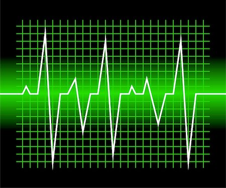 frequency - Abstract musical inspired graphical background image with peaks. Foto de stock - Super Valor sin royalties y Suscripción, Código: 400-05251752