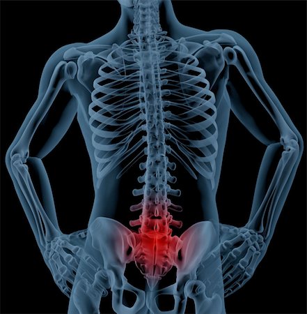 simsearch:400-06768229,k - 3D render of a skeleton highlighting pain in the back Fotografie stock - Microstock e Abbonamento, Codice: 400-05260482