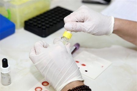 Nurse doing blood sugar test on patient with Diabetes Fotografie stock - Microstock e Abbonamento, Codice: 400-05335848