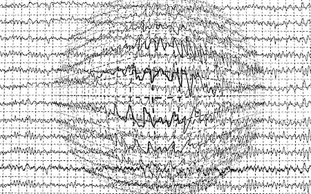 Brain wave encephalogramme EEG isolated on white background Stock Photo - Budget Royalty-Free & Subscription, Code: 400-05339607