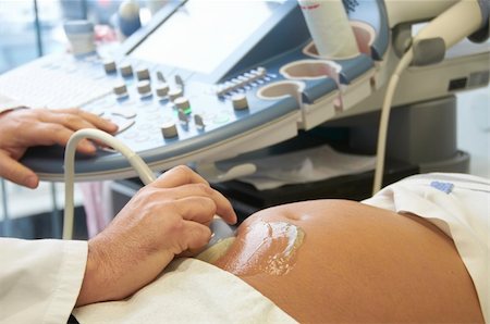 pregnant scan - ultrasound Foto de stock - Super Valor sin royalties y Suscripción, Código: 400-05385124