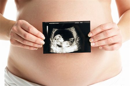 pregnant scan - Detail Of Pregnant Woman Holding Ultrasound Scan Foto de stock - Super Valor sin royalties y Suscripción, Código: 400-05686517
