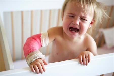 Crying Toddler With Arm In Cast Stockbilder - Microstock & Abonnement, Bildnummer: 400-05686534