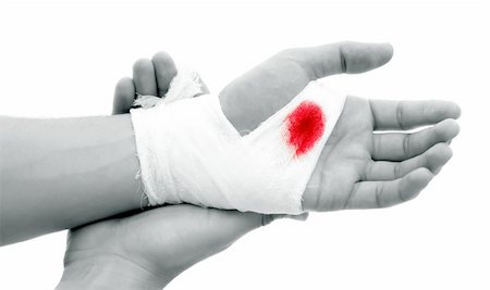 simsearch:400-04447310,k - Hand of a man with bloody gauze on it Stock Photo - Budget Royalty-Free & Subscription, Code: 400-05693165