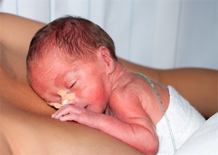 frühgeburt - mother carrying her premature baby on her breast Stockbilder - Microstock & Abonnement, Bildnummer: 400-05716846