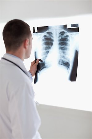 simsearch:400-05710928,k - Doctor holding x-ray photograph against light Stockbilder - Microstock & Abonnement, Bildnummer: 400-05710434