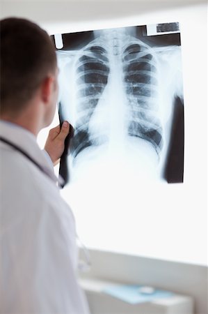 simsearch:400-05710928,k - Close up of doctor using light to check x-ray photograph Stockbilder - Microstock & Abonnement, Bildnummer: 400-05710438