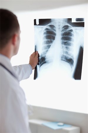 simsearch:400-05710928,k - Close up of doctor holding x-ray image against light Stockbilder - Microstock & Abonnement, Bildnummer: 400-05710439