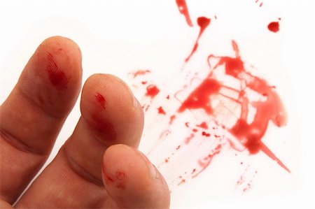 human hand with blood stains, crime scene detail photo Stock Photo - Budget Royalty-Free & Subscription, Code: 400-05890894