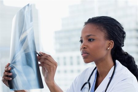 Focused female doctor looking at a set of X-rays in her office Stock Photo - Budget Royalty-Free & Subscription, Code: 400-05900827