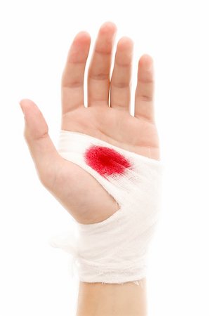 simsearch:400-04447310,k - Hand of a man with bloody gauze on it Stock Photo - Budget Royalty-Free & Subscription, Code: 400-06476963