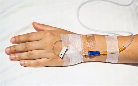 Medical intravenous cannula in his hand a sick person Stock Photo - Budget Royalty-Free & Subscription, Code: 400-06568262