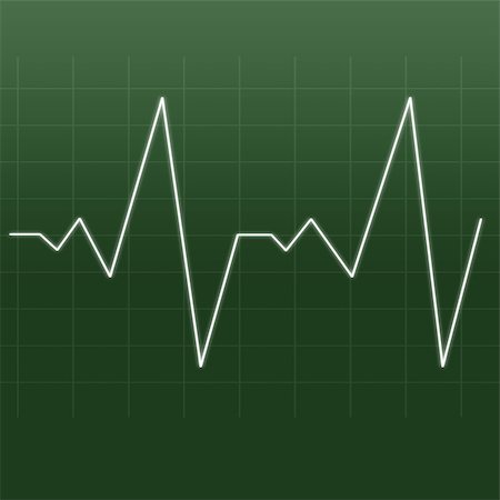 elettrocardiogramma - Heartbeat being drawn by a white line against a green background Fotografie stock - Microstock e Abbonamento, Codice: 400-06689004