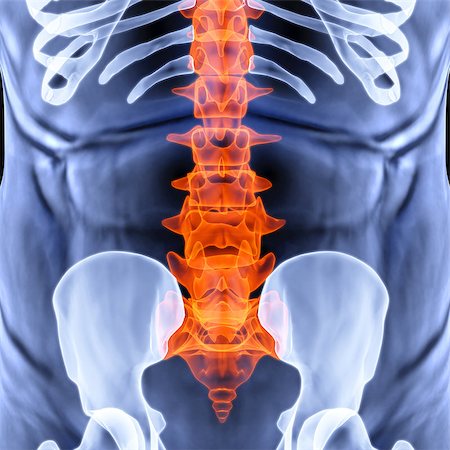 torso men under X-rays. backbone is highlighted in red. Stock Photo - Budget Royalty-Free & Subscription, Code: 400-06736965