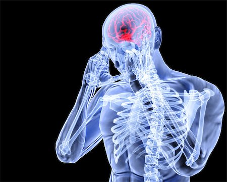 pains at the head bone - a man with a headache under x-ray. Stock Photo - Budget Royalty-Free & Subscription, Code: 400-06736962
