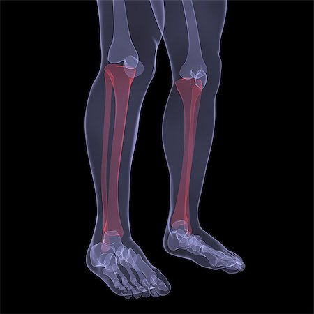 simsearch:400-05715953,k - X-ray of human legs. Render on a black background Stock Photo - Budget Royalty-Free & Subscription, Code: 400-06749404