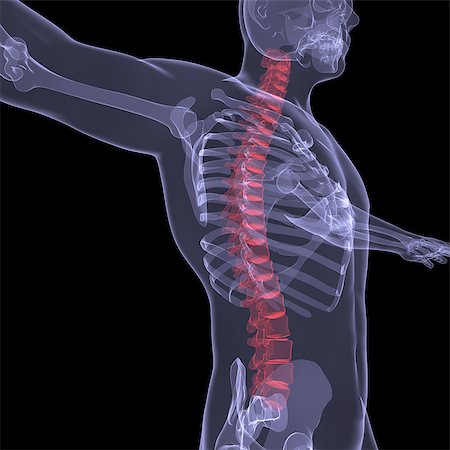 simsearch:400-05715953,k - X-ray of the human spine. Render on a black background Stock Photo - Budget Royalty-Free & Subscription, Code: 400-06749440