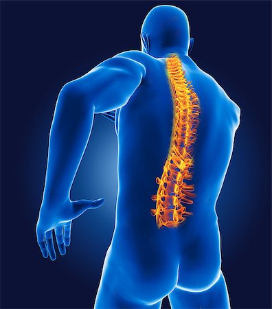 simsearch:400-06768229,k - 3D medical man with skeleton spine highlighted Fotografie stock - Microstock e Abbonamento, Codice: 400-06758520