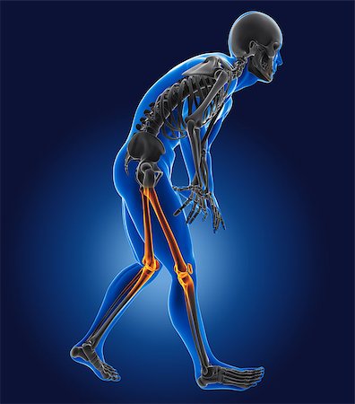 3D medical man with thigh bone highlighted Stock Photo - Budget Royalty-Free & Subscription, Code: 400-06854161