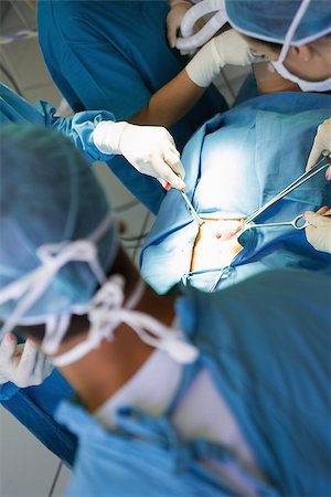 Surgeon performing an operation on a stomach in a hospital operating theater Stock Photo - Budget Royalty-Free & Subscription, Code: 400-06868016