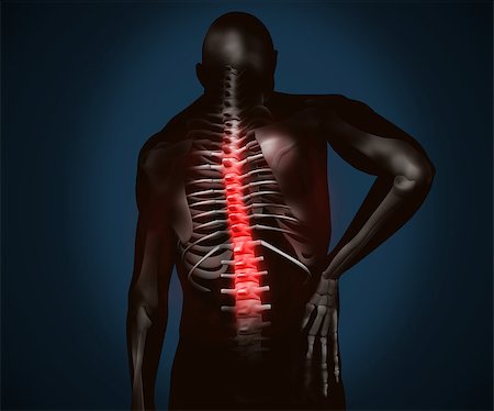 Black digital figure with highlighted back pain Stock Photo - Budget Royalty-Free & Subscription, Code: 400-06872977