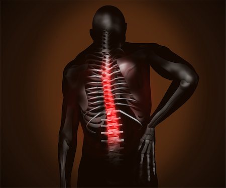 Black digital man with back pain and highlighted spine Stock Photo - Budget Royalty-Free & Subscription, Code: 400-06872978