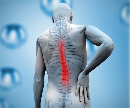 spine anatomy back view - Digital figure showing skeleton with highlighted back pain Stock Photo - Budget Royalty-Free & Subscription, Code: 400-06872999