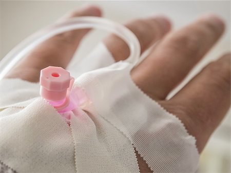 prescription bags - Picture of a hand with infusion needle Stock Photo - Budget Royalty-Free & Subscription, Code: 400-06887057