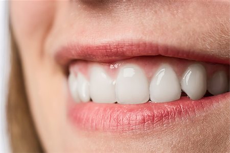 Closeup of the white teeth of a young woman with red lips Stock Photo - Budget Royalty-Free & Subscription, Code: 400-07038551