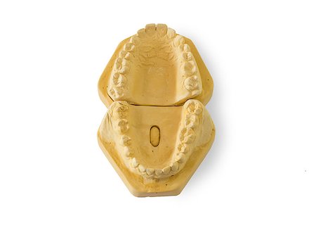Upper and lower dental gypsum cast , with white background Photographie de stock - Aubaine LD & Abonnement, Code: 400-07042702
