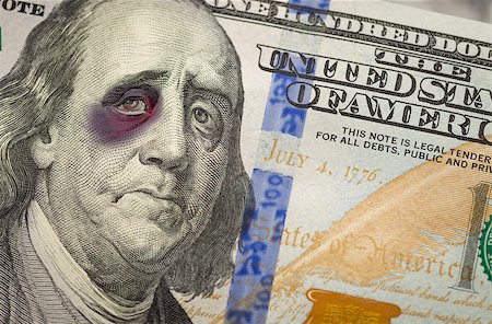franklin - Bruised, Battered and Black Eyed Ben Franklin on the Newly Designed United States One Hundred Dollar Bill. Stock Photo - Budget Royalty-Free & Subscription, Code: 400-07184873