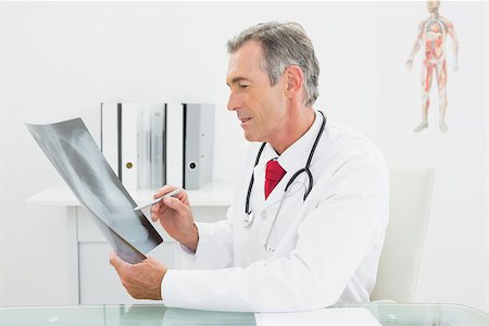 simsearch:400-07269250,k - Concentrated male doctor looking at x-ray picture of lungs in the medical office Stock Photo - Budget Royalty-Free & Subscription, Code: 400-07230980