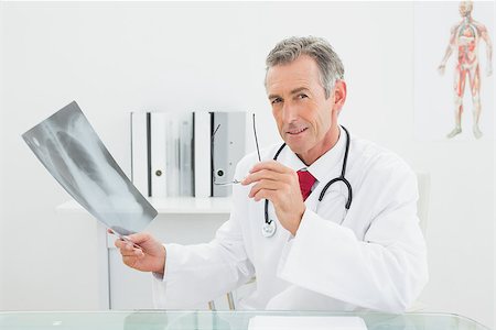 simsearch:400-07269250,k - Portrait of a confident male doctor with x-ray picture of lungs in the medical office Stock Photo - Budget Royalty-Free & Subscription, Code: 400-07230983