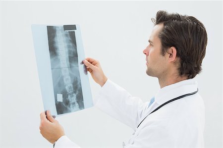 simsearch:400-07269250,k - Side view of a concentrated male doctor examining spine x-ray over white background Stock Photo - Budget Royalty-Free & Subscription, Code: 400-07232001