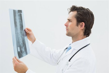 simsearch:400-07269250,k - Side view of a concentrated male doctor examining spine x-ray over white background Stock Photo - Budget Royalty-Free & Subscription, Code: 400-07232002