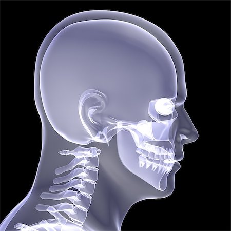 simsearch:700-00150546,k - The man's head. X-ray render on a black background Foto de stock - Royalty-Free Super Valor e Assinatura, Número: 400-07250844